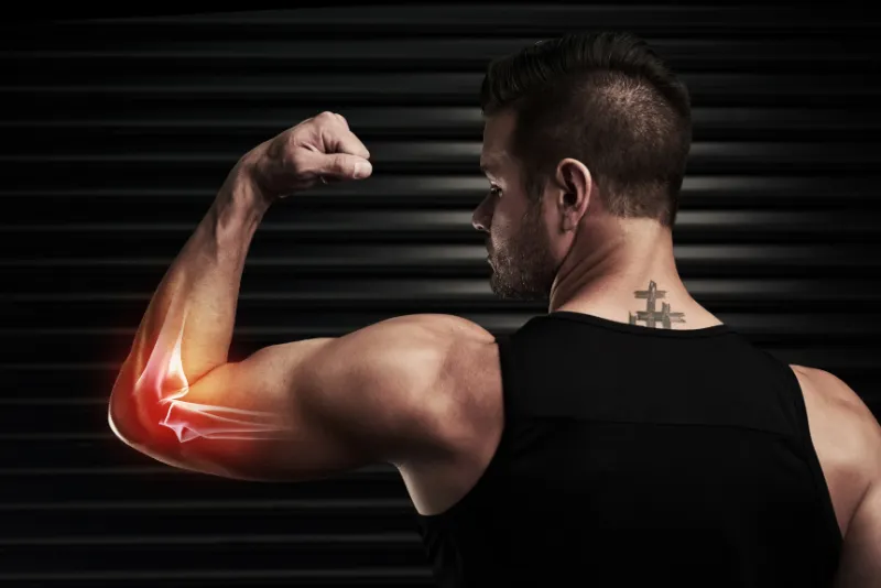 a young man flexing his arm with an elbow injury